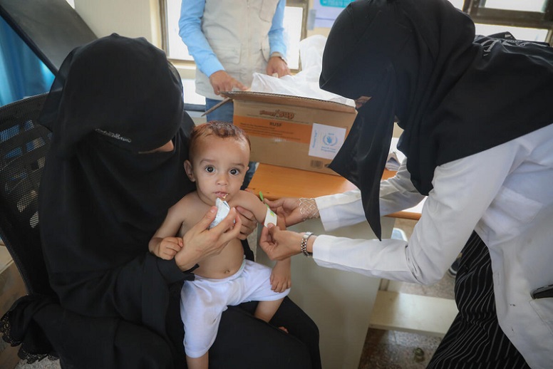 A a year and seven months old boy from Yemen is fed with supplementary food and is measured for malnutrition.