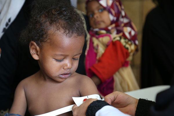 مدير برنامج الأغذية العالمي تحذر من تفاقم أزمة الغذاء في اليمن وسط تحديات بشأن الوصول إلى المتضررين ونقص التمويل