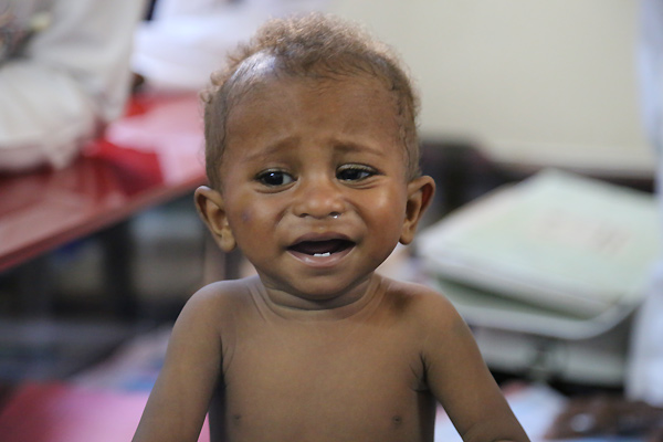 وكالات تابعة للأمم المتحدة تطلق نداءً للحصول على مساعدات عاجلة لتفادي وقوع كارثة في اليمن في ظل تفاقم أزمة الغذاء