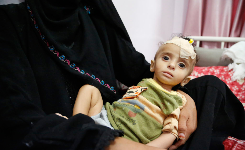 اليمن. صورة: برنامج الأغذية العالمي/ريم ندا