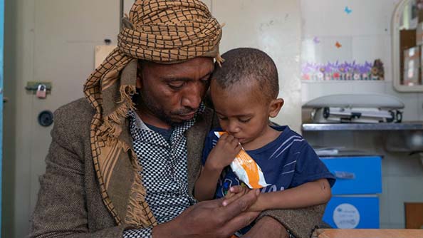 سلطان، البالغ من العمر 21 شهراً، واحد من بين مليوني طفل يمني يحتاجون إلى المساعدات الغذائية. الصورة: برنامج الأغذية العالمي/محمد عوض