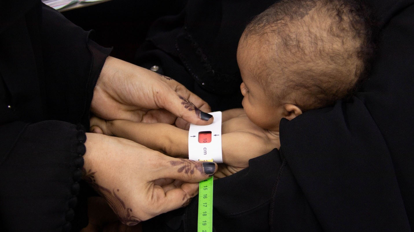 يعاني مليونا طفل ومليون امرأة حاليًا من سوء التغذية الحاد في اليمن. ويتوقع برنامج الأغذية العالمي أن ترتفع هذه الأرقام مع ارتفاع حالات الإصابة بفيروس كورونا. الصور: برنامج الأغذية العالمي/محمد عوض