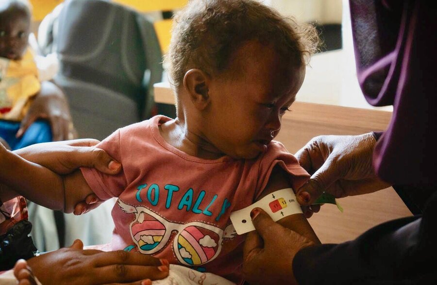 Fifteen-month-old Aisha shows signs of severe acute malnutrition during this test at a WFP-supported nutrition center in Port Sudan. Photo: WFP/Abubakar Garelnabei