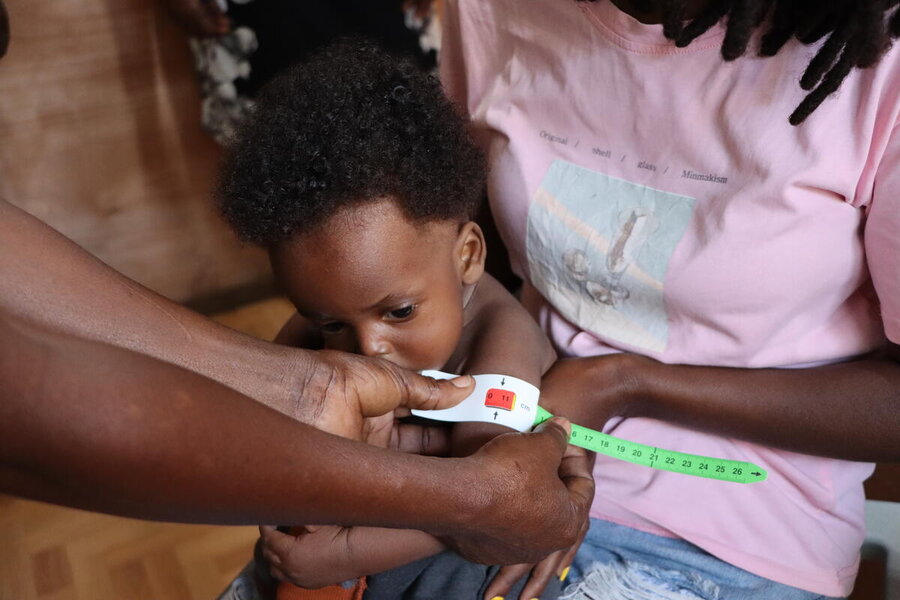 UNHAS flights allow thousands of humanitarian workers to reach vulnerable people  - like this child, in northern Haiti, who shows signs of severe malnourishment. WFP/Alexis Masciarelli