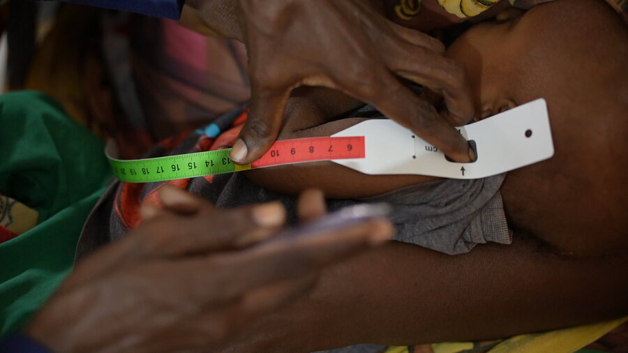 The arm of a small child being tested for malnutrition - with a band indicating red for severely malnourished - at a Khartoum nutrition centre. Photo: WFP/Mohamed Elamin