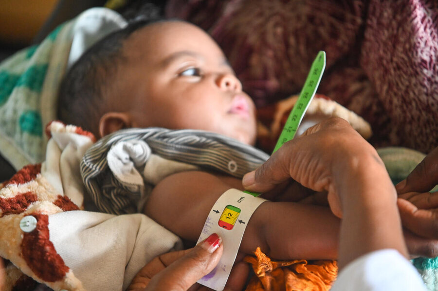 Health worker measures a child’s upper arm with a colour-coded nutrition band during a health screening, assessing nutritional status and growth.