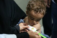 برنامج الأغذية العالمي يعرب عن قلقه إزاء تزايد معدلات الجوع وسوء التغذية في اليمن الذي مزقه الحرب